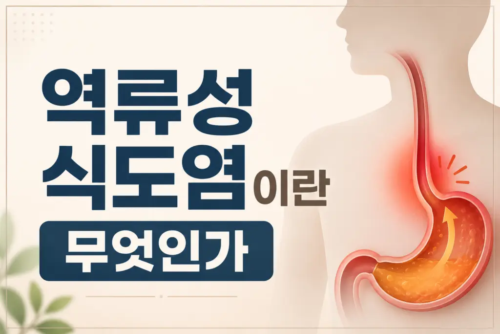 역류성식도염 1024x683